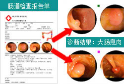 肠道检查报告单